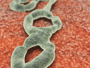 ebola virus lead