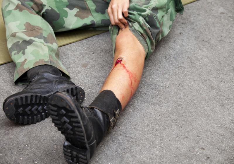 gunshot wound on soldiers leg | how to treat a gunshot wound to the leg